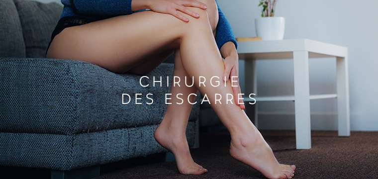 Chirurgie des escarres